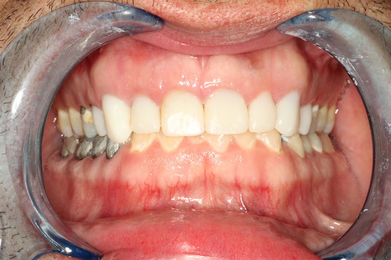 case 2b after humiston